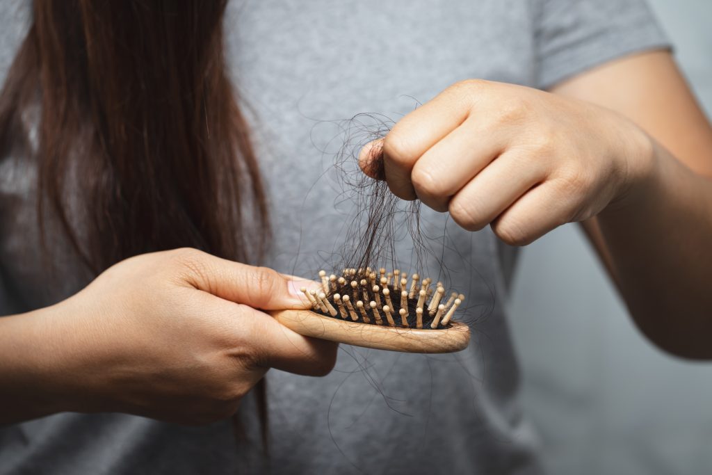 A woman with long hair pulls out hair from her hair brush, demonstrating hair fall and hair loss. 