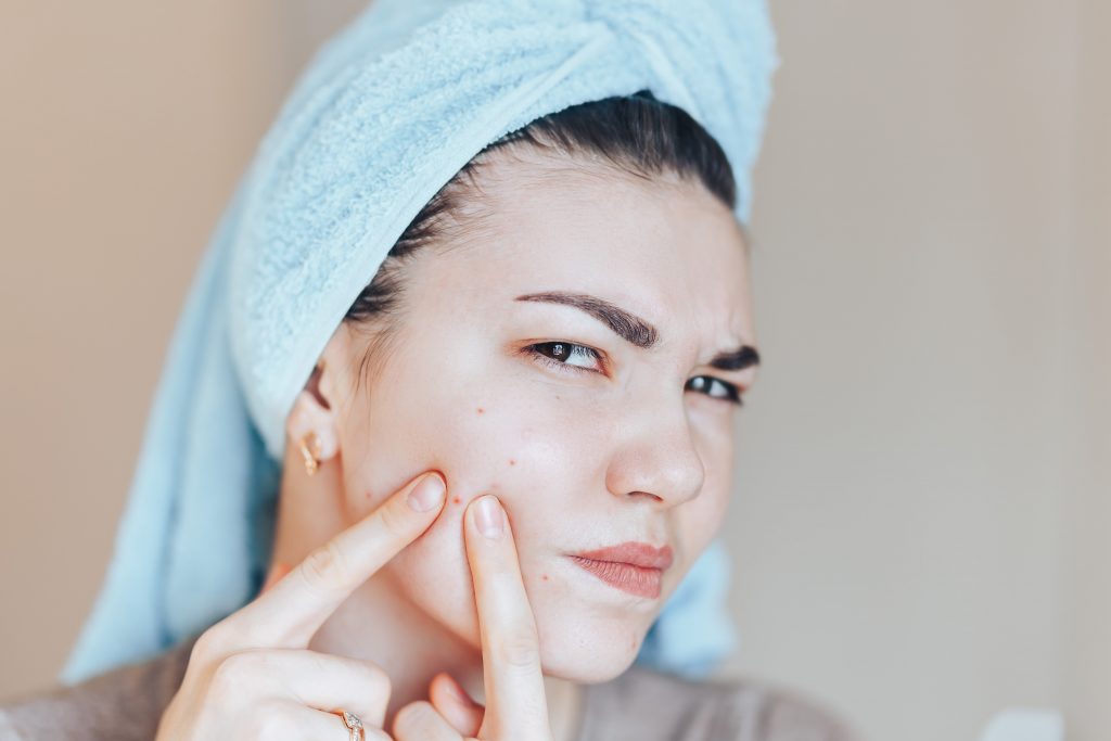 A young woman wearing a towel on her head looks at the camera and picks the pimples on her cheek. Concept of skin picking, acne, skin habits.